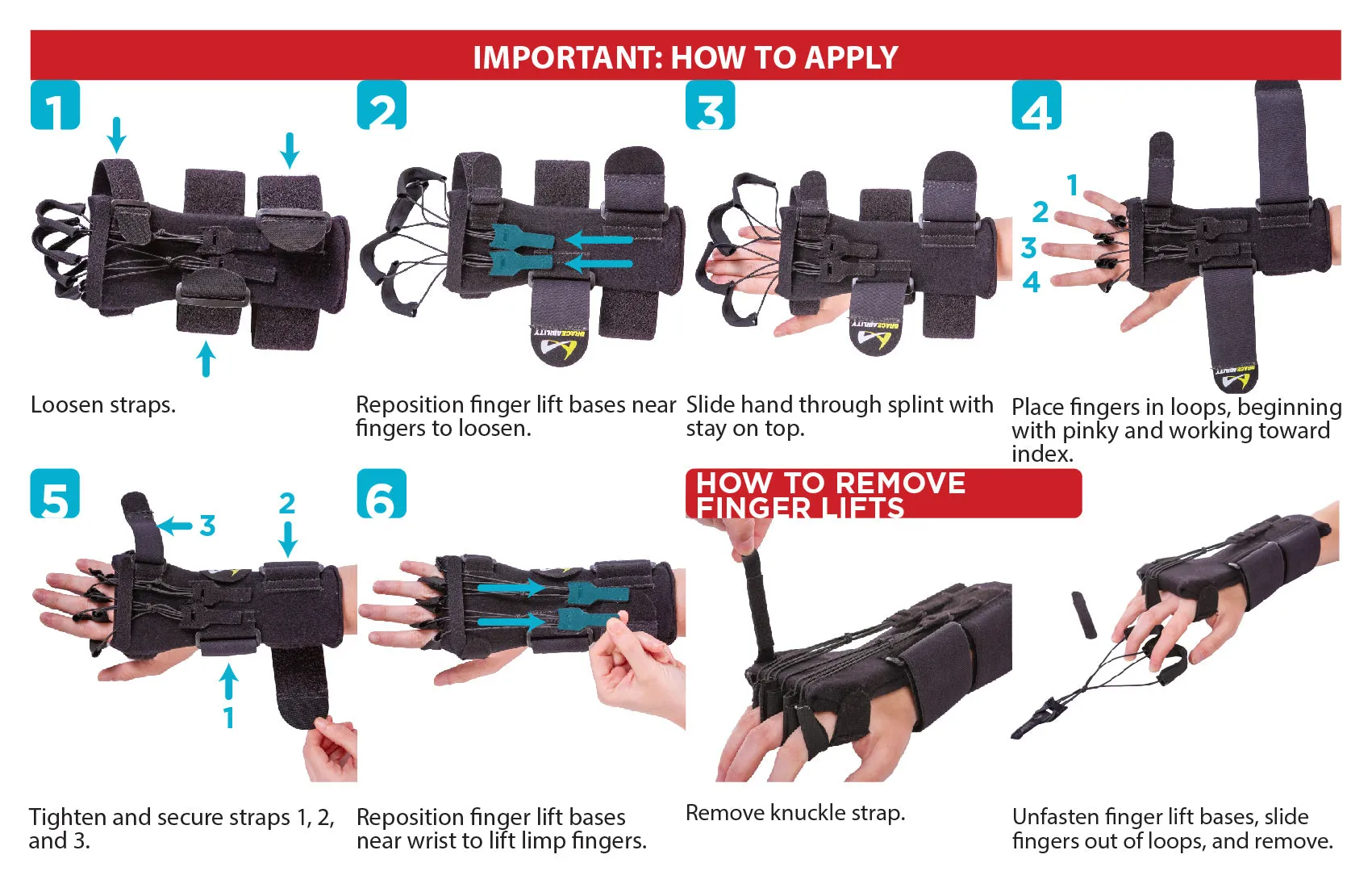 Radial Nerve Palsy Splint | Dynamic Wrist Drop & Finger Extension Brace for Saturday Night, Honeymoon & Crutch Palsy