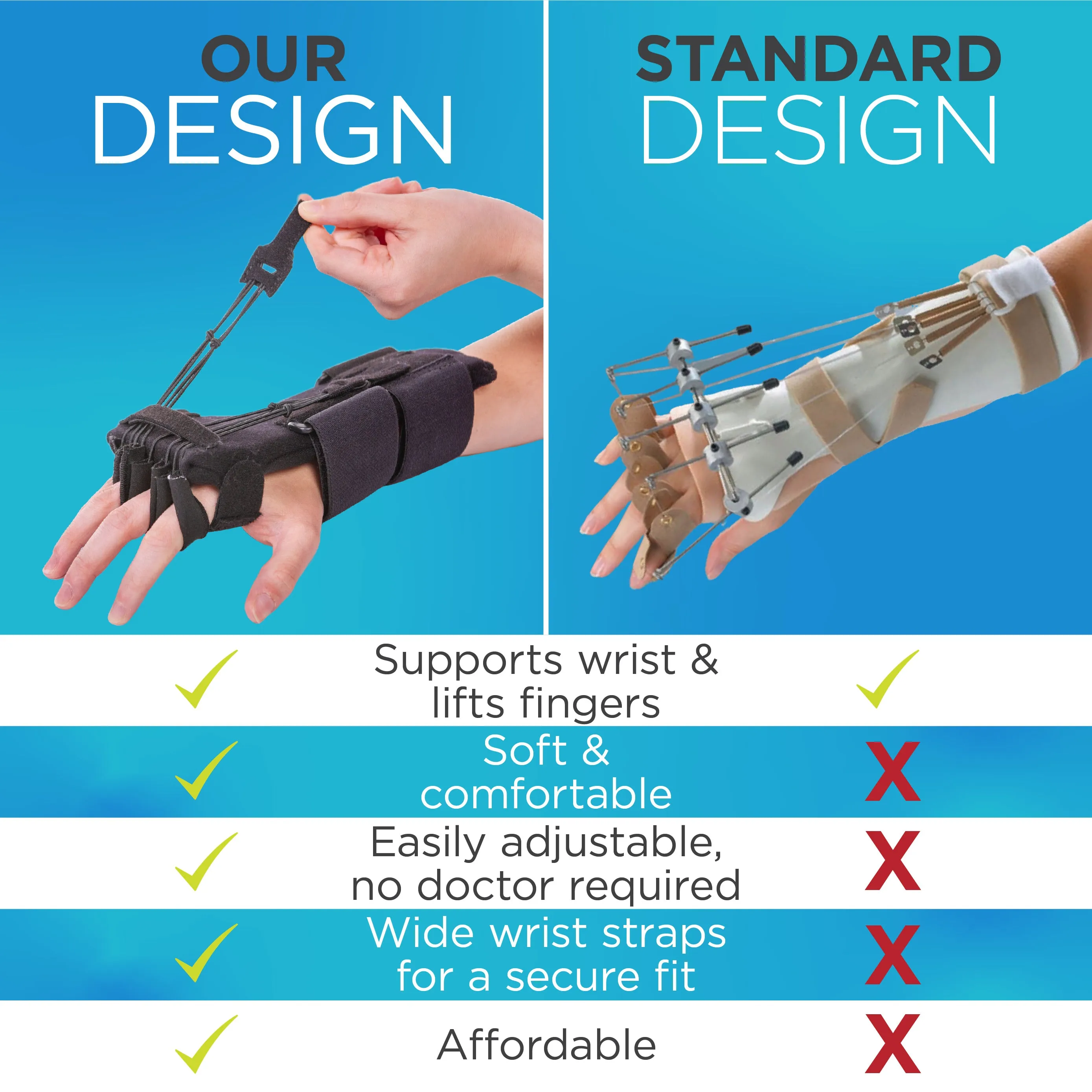 Radial Nerve Palsy Splint | Dynamic Wrist Drop & Finger Extension Brace for Saturday Night, Honeymoon & Crutch Palsy